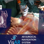 FIRST FULLY IMMERSIVE 3D AUGMENTED REALITY SURGICAL NAVIGATION SYSTEM ACHIEVES FDA APPROVAL FOR PRECISION SPINE SURGERY