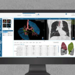 VIDA-Launches-VIDA-Intelligence-Portal-2.0-to-Accelerate-Onboarding-of-Clinical-Trial-Sites