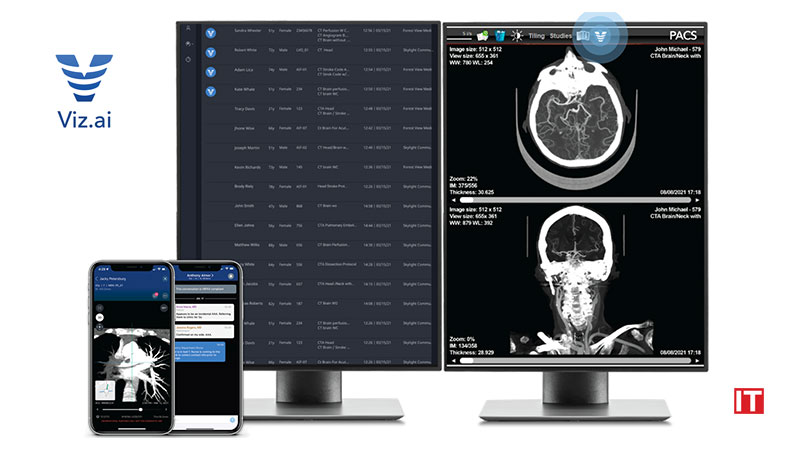 Viz.ai-Launches-AI-powered-Viz™-Radiology-Suite