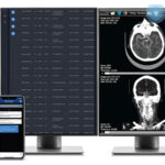 Viz.ai-Launches-AI-powered-Viz™-Radiology-Suite