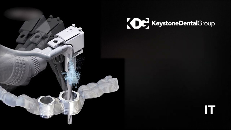 Keystone Dental