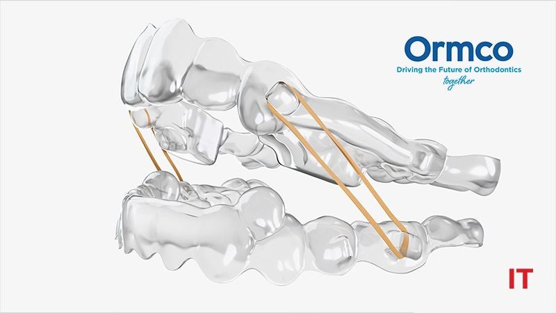 Ormco