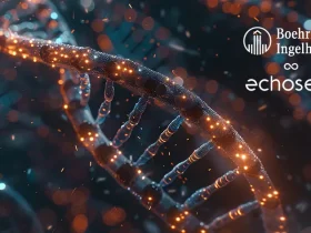 Echosens