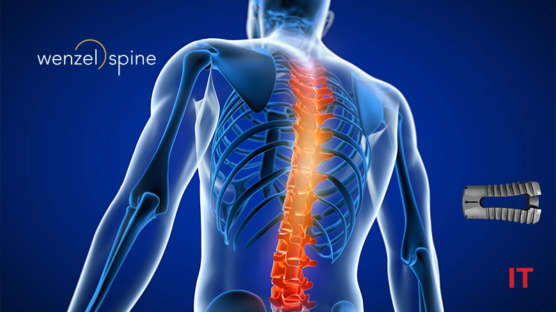 Wenzel Spine